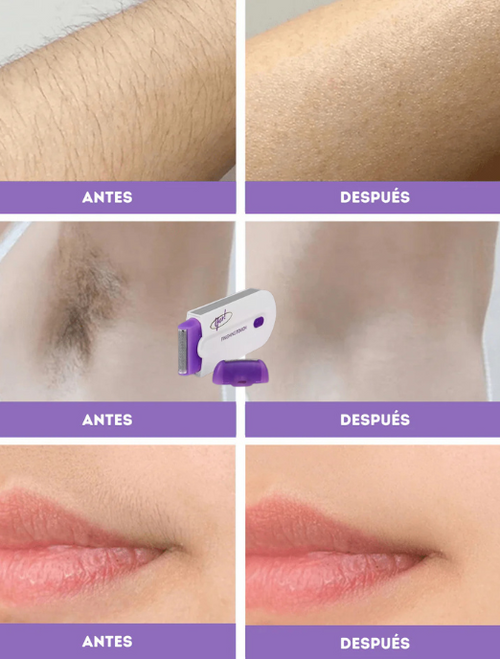 ¡Despídete de esos molestos vellos, sin dolor ni irritación!